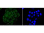 EZH2 Antibody in Immunocytochemistry (ICC/IF)