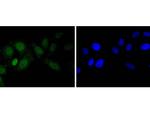 EZH2 Antibody in Immunocytochemistry (ICC/IF)