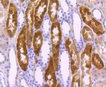 ITGA5 Antibody in Immunohistochemistry (Paraffin) (IHC (P))