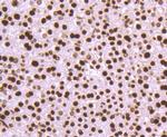 Histone H3 Antibody in Immunohistochemistry (Paraffin) (IHC (P))