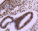 Histone H3 Antibody in Immunohistochemistry (Paraffin) (IHC (P))