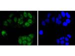 Cdc5L Antibody in Immunocytochemistry (ICC/IF)