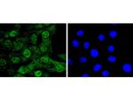 Cdc5L Antibody in Immunocytochemistry (ICC/IF)