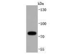 RIP1 Antibody in Western Blot (WB)