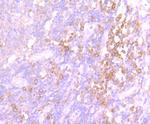 SRC Antibody in Immunohistochemistry (Paraffin) (IHC (P))