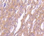 SRC Antibody in Immunohistochemistry (Paraffin) (IHC (P))