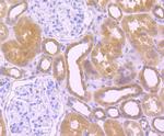 SRC Antibody in Immunohistochemistry (Paraffin) (IHC (P))