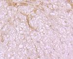 SRC Antibody in Immunohistochemistry (Paraffin) (IHC (P))