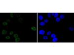 Progesterone Receptor Antibody in Immunocytochemistry (ICC/IF)