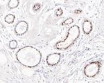 Progesterone Receptor Antibody in Immunohistochemistry (Paraffin) (IHC (P))