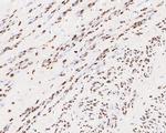 Progesterone Receptor Antibody in Immunohistochemistry (Paraffin) (IHC (P))