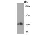 alpha Actinin 2 Antibody in Western Blot (WB)