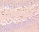 SOD1 Antibody in Immunohistochemistry (Paraffin) (IHC (P))