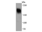 PDGFRA Antibody in Western Blot (WB)