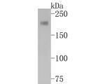 PDGFRA Antibody in Western Blot (WB)