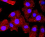 Bcl-2 Antibody in Immunocytochemistry (ICC/IF)