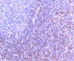 Bcl-2 Antibody in Immunohistochemistry (Paraffin) (IHC (P))