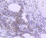 Bcl-2 Antibody in Immunohistochemistry (Paraffin) (IHC (P))