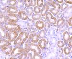 Bcl-2 Antibody in Immunohistochemistry (Paraffin) (IHC (P))