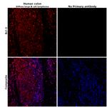 Bcl-2 Antibody in Immunohistochemistry (Paraffin) (IHC (P))