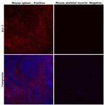 Bcl-2 Antibody in Immunohistochemistry (Paraffin) (IHC (P))