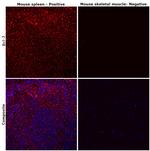 Bcl-2 Antibody in Immunohistochemistry (Paraffin) (IHC (P))