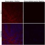 Bcl-2 Antibody