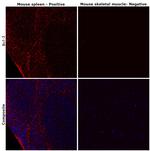 Bcl-2 Antibody