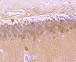 Calbindin D28K Antibody in Immunohistochemistry (Paraffin) (IHC (P))