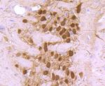 Calbindin D28K Antibody in Immunohistochemistry (Paraffin) (IHC (P))