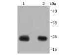 Calbindin D28K Antibody in Western Blot (WB)