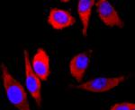 Parkin Antibody in Immunocytochemistry (ICC/IF)