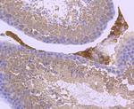 Parkin Antibody in Immunohistochemistry (Paraffin) (IHC (P))