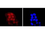 KLF4 Antibody in Immunocytochemistry (ICC/IF)