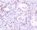 KLF4 Antibody in Immunohistochemistry (Paraffin) (IHC (P))