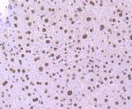 KLF4 Antibody in Immunohistochemistry (Paraffin) (IHC (P))