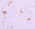 NF-H Antibody in Immunohistochemistry (Paraffin) (IHC (P))