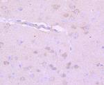 NF-H Antibody in Immunohistochemistry (Paraffin) (IHC (P))