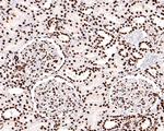 53BP2 Antibody in Immunohistochemistry (Paraffin) (IHC (P))