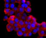 NGAL Antibody in Immunocytochemistry (ICC/IF)