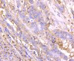 NGAL Antibody in Immunohistochemistry (Paraffin) (IHC (P))