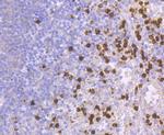 NGAL Antibody in Immunohistochemistry (Paraffin) (IHC (P))