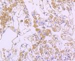 NGAL Antibody in Immunohistochemistry (Paraffin) (IHC (P))