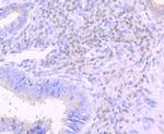NGAL Antibody in Immunohistochemistry (Paraffin) (IHC (P))
