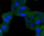 BNIP3 Antibody in Immunocytochemistry (ICC/IF)