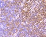 IDH2 Antibody in Immunohistochemistry (Paraffin) (IHC (P))