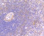 JAK3 Antibody in Immunohistochemistry (Paraffin) (IHC (P))