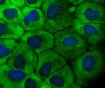 TAK1 Antibody in Immunocytochemistry (ICC/IF)