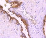 SERPINA3 Antibody in Immunohistochemistry (Paraffin) (IHC (P))