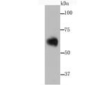 SERPINA3 Antibody in Western Blot (WB)